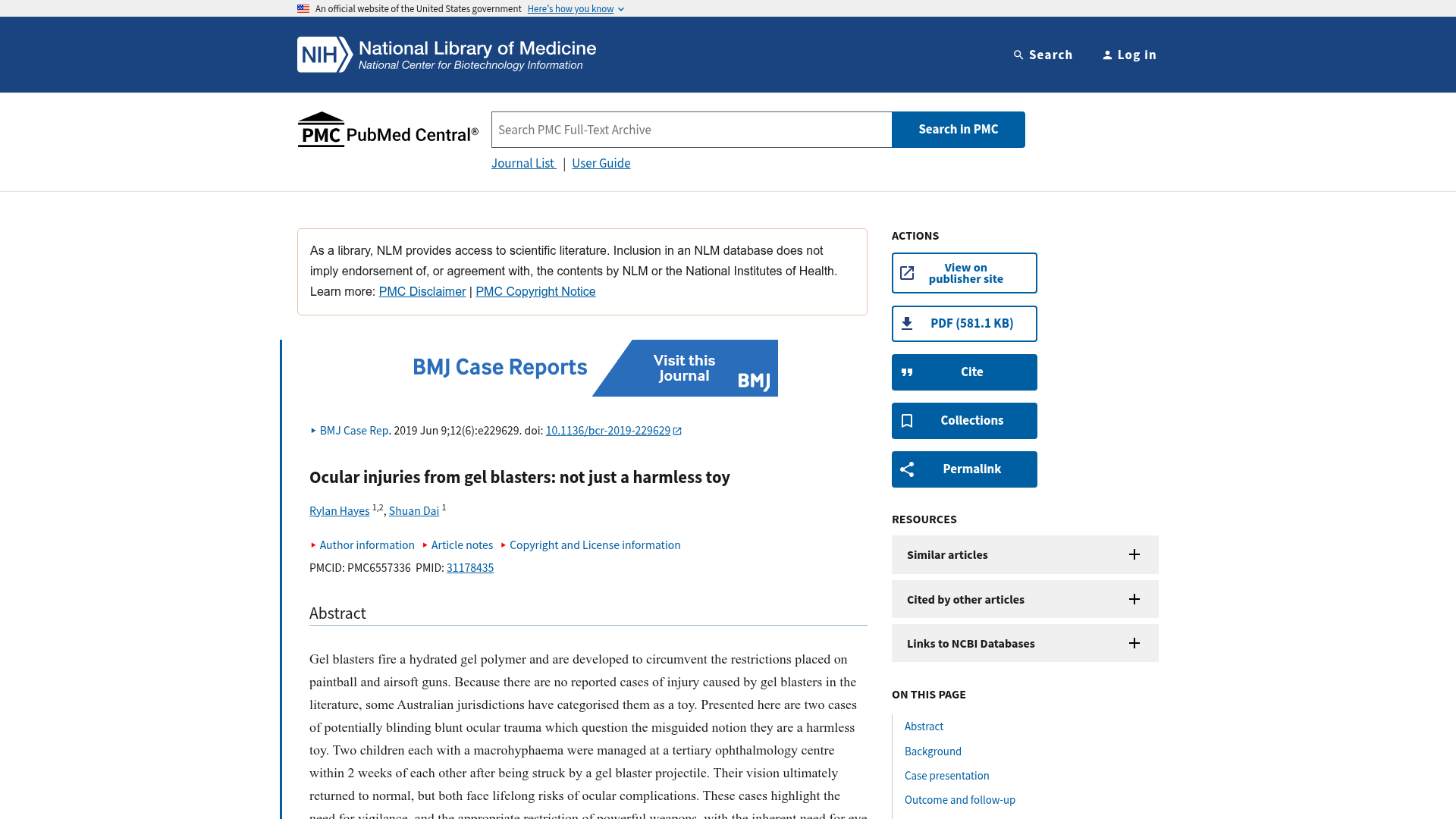 BMJ Case Reports study: Ocular injuries from gel blasters, not just a harmless toy