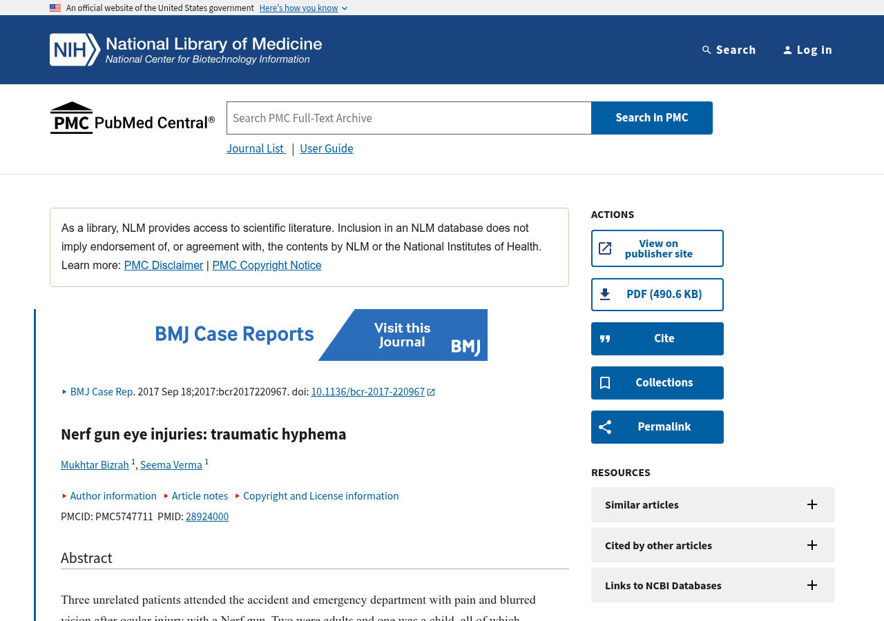 BMJ Case Reports on PubMed Central: Nerf gun eye injuries, traumatic hyphema